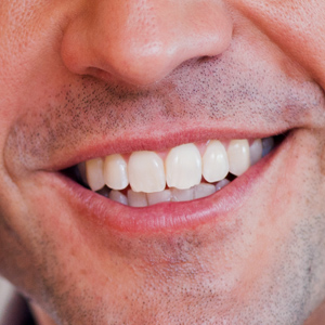 dentist perfect white smile richmond dental suite
