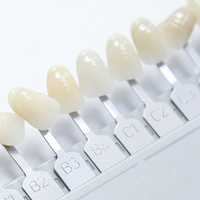 Dental implants